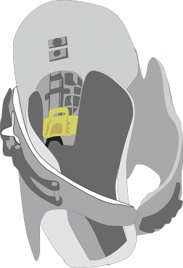 Adjustable Flex