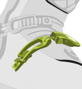 Inverted Forefoot Buckle